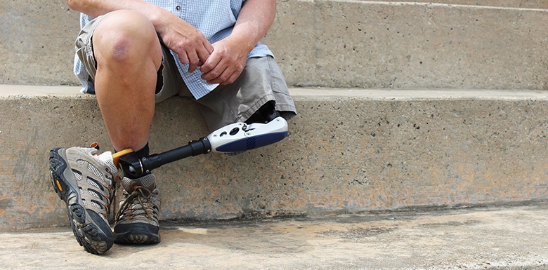 Amputee on the stairs